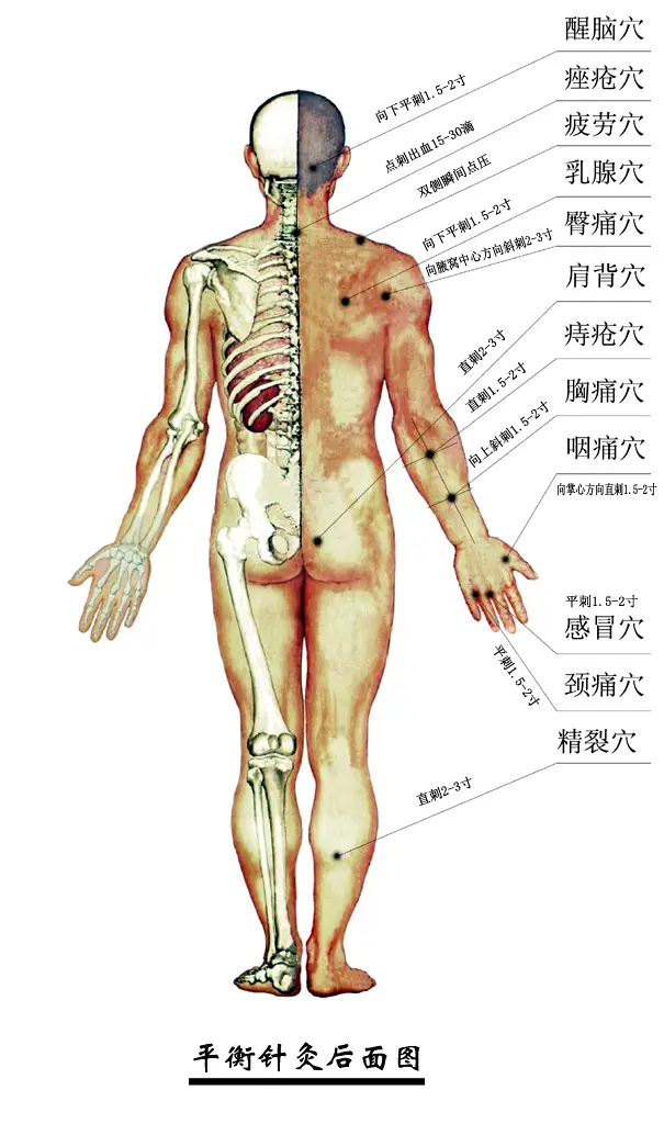 平衡针灸穴位图后
