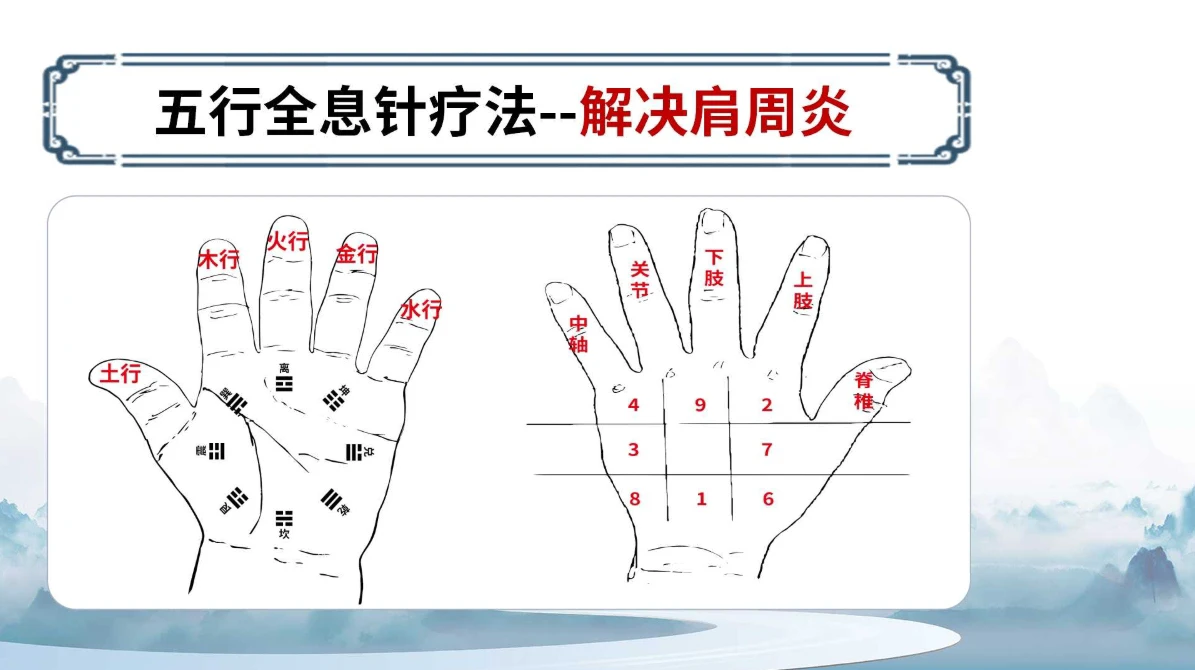 杨氏全息针——肩周炎调理方法（附针灸位置图）！