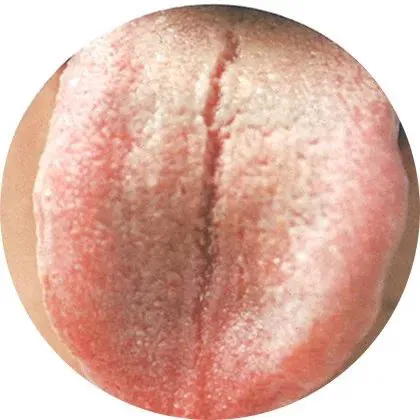 裂纹舌1
