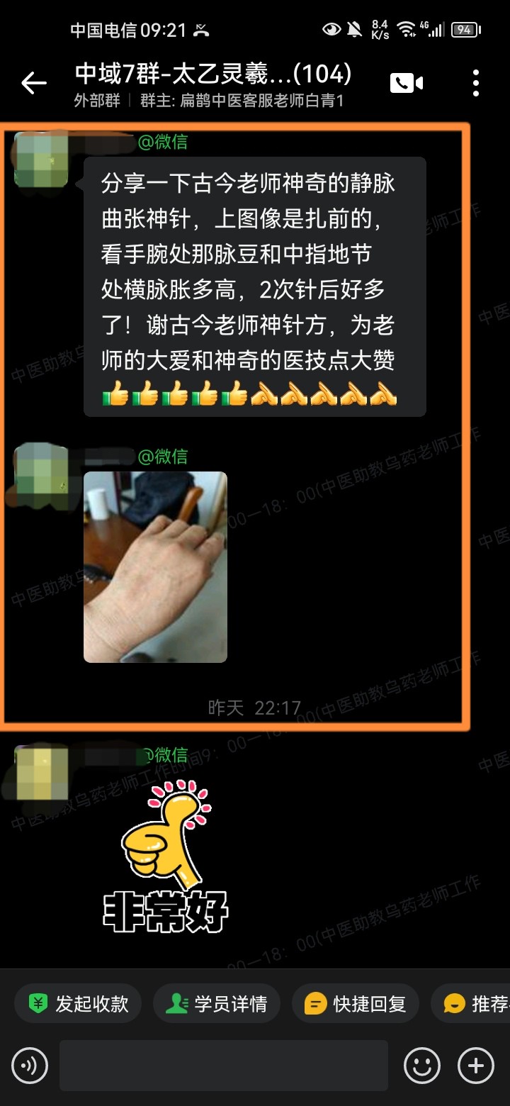 太乙灵羲术学员反馈：手腕处静脉曲张，运用太乙针灸2次后改善很多！