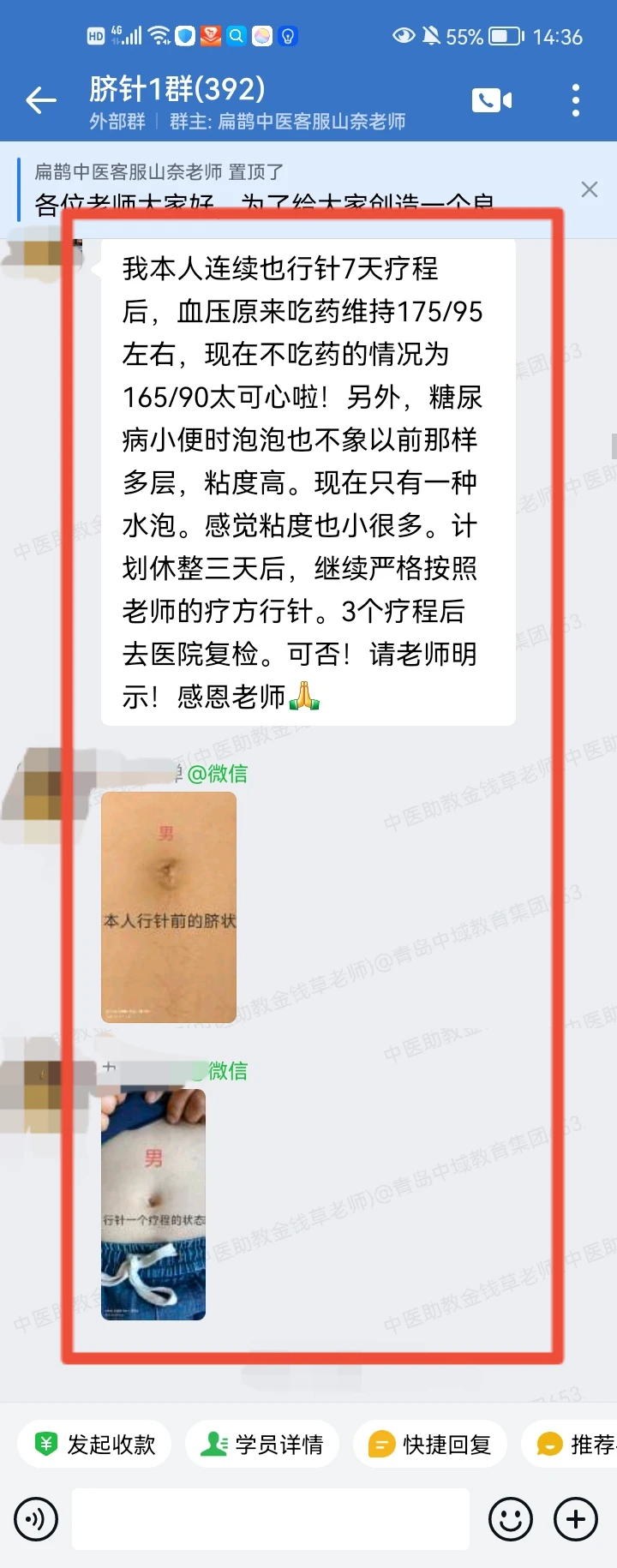 太极八卦脐针学员反馈：高血压调理后改变明显；调理大肚子也变小了！