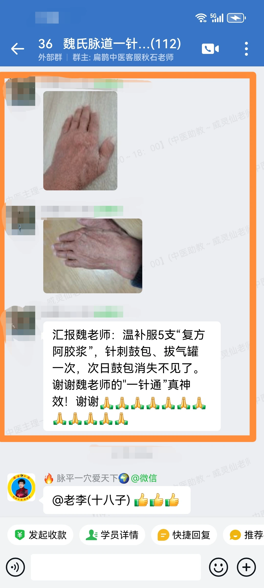 魏氏脉道气血一针通学员反馈：头痛、腰痛、肌无力，血管内淤等患者，调理后大为好转！